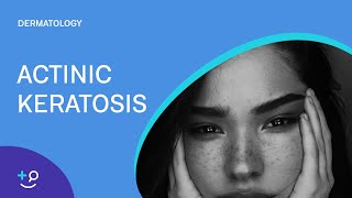 Actinic Keratosis Dermatology [upl. by Narual297]