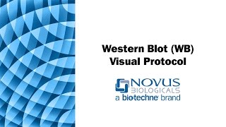 Western Blot WB Visual Protocol [upl. by Hadias547]