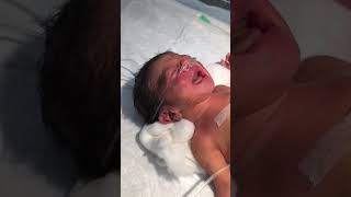 Newborn baby sleeping😴👍 youtubeshorts nursing sumitnicunursingstm sleeping baby viralvideo [upl. by Ardnal372]