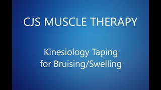 Kinesiology Taping K taping for Swelling and Bruising [upl. by Alyak]