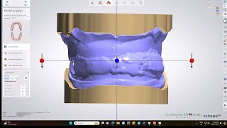 CUDCLD Design with 3D Biteplate [upl. by Granoff762]