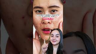 Ayurvedic creams for Acne  Affordable facedecor [upl. by Tiertza]