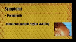 Acute parotitis in neonates Patient teaching programme Tamil [upl. by Adym]