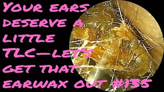 Your ears deserve a little TLC—let’s get that earwax out 135 [upl. by Bible]