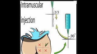 How to give Intramuscular injection in Gluteal region 💉🩸 injection medicos medical [upl. by Onit]