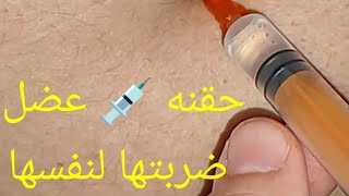 ابره عضل 💉 ضربتها لنفسها ياقلبك ياصفرا 😱😱 [upl. by Boleslaw]