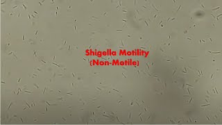 Shigella sonnei Motility [upl. by Auqinaj]