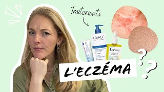 Tout savoir sur L’ECZÉMA avec témoignage d’une cliente [upl. by Harbison]