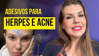 Adesivo que seca acne e herpes solução ou problema Dermatologista explica se realmente funciona [upl. by Airret]