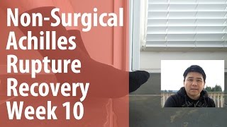 NonSurgical Achilles Rupture Recovery  Week 10 [upl. by Nathanoj]