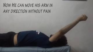 Best Physiotherapy Treatment for post Fracture Shoulder Pain [upl. by Eninaj]