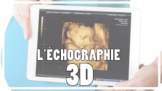 GROSSESSE Léchographie 3D  Lue Exina [upl. by Nodla]