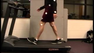 Walking Gait Analysis [upl. by Terag]