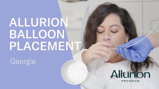 Georgies Allurion Gastric Balloon Placement [upl. by Nueoht]