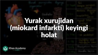 Yurak xurujidan miokard infarkti keyingi holat  Tibbiyot [upl. by Samuele]