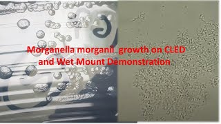 Morganella morganii Colony Morphology and Microscopy [upl. by Burnard]