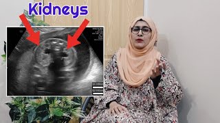 how to know gender of baby on ultrasound  pyelectasis of fetus shows baby boy  gender reveal scan [upl. by Dorella]