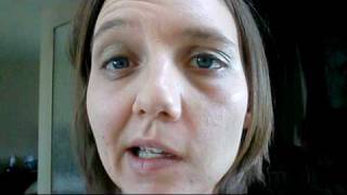 Bells Palsy Update  Day 66 95 Weeks [upl. by Jojo]