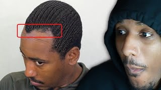 BARBER TAKES ON A 720 WAVER WITH A DIFFICULT HAIRLINE LOL WOW [upl. by Godliman296]