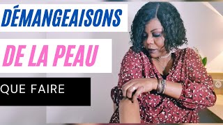 Comment TRAITER Les DÉMANGEAISONS de la peau àprés une douche peau sèche [upl. by Notyalk]