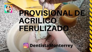 ⏭️ PROVISIONAL FERULIZADO 👅 PASOS PULIDO DIENTE PROVISIONAL ACRILICO [upl. by Vanhook521]