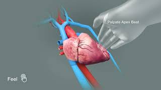 Tricuspid Regurgitation [upl. by Koffman]