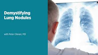 Demystifying Lung Nodules [upl. by Notwal]