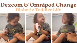 NEW DEXCOM amp OMNIPOD AT THE SAME TIME type1diabetes [upl. by Pritchard]