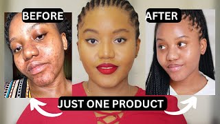 HOW TO GET RID OF DARK SPOTS WITH ONE PRODUCT  SERUM THAT WORKS [upl. by Auqenaj64]