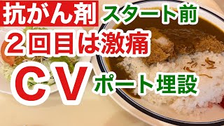 【肺腺がん直腸がん再発】２度目で硬くなった静脈に針が刺さらず大混乱？ [upl. by Tat]