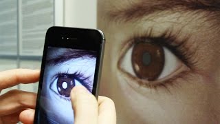 Detect Eye Cancer Retinoblastoma with Your Smart Phone – CHECT UK [upl. by Laeira148]