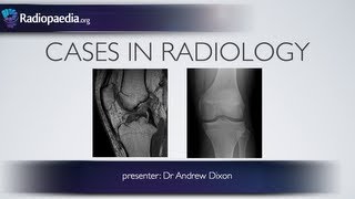 Cases in Radiology Episode 4 musculoskeletal MRI xray [upl. by Claudia]