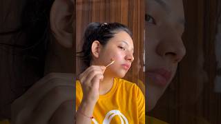 DIY Spot Treatment for ACNE🐱 skincare acnetreatment diy shortsvideo [upl. by Tjader]