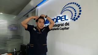 CÓMO APLICAR MINOXIDIL AL 5 [upl. by Rhyne]