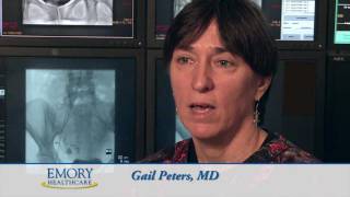 Why Choose Emory for uterine fibroid embolization UFE [upl. by Mines]