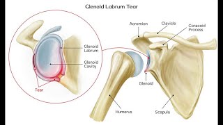 Orthopedic supracondylar fracture elbow dislocation fracture olecranon MRCS Academy بالعربي [upl. by Brodie405]