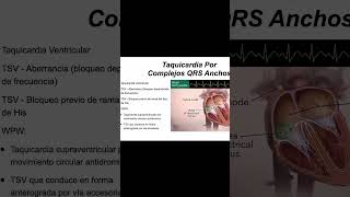 Cómo Diagnosticar Taquicardias de QRS Ancho Claves y Criterios Dr Antonio Miranda [upl. by Alaaj]