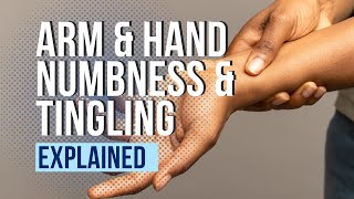 Arm and Hand Numbness and Tingling Explained [upl. by Roybn]