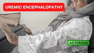 HOW TO MANAGE UREMIC ENCEPHALOPATHY  SIGNS  SYMPTOMS  CKD TREATMENT BY MD MEDICINE DOCTOR [upl. by Zandt]