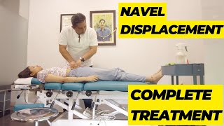 Chiropractic Adjustment for Umbilical or Navel Displacement Restoring Balance and Alleviating Pain [upl. by Redna]