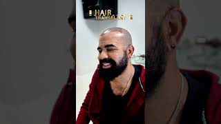 Transplant in Care4Hair  Miami Florida hairlosstreatment [upl. by Elleined162]