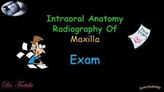 Normal radiographic anatomical landmarks Intraoral Radiographic Anatomy of the Maxilla Dental exam [upl. by Cod]