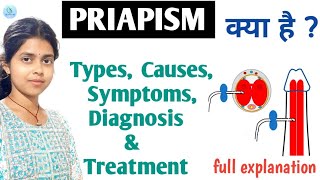 Priapism causes symptoms treatment  Erection Problem  Prolonged erection  Erectile Dysfunction [upl. by Najed994]