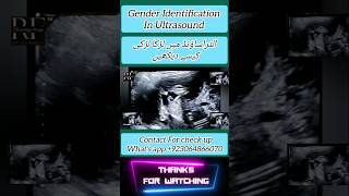 Gender Identification Ultrasound Short [upl. by Callahan]