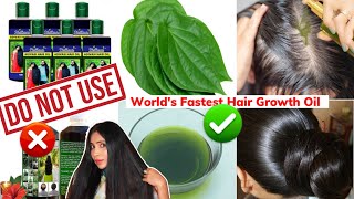 Got 10x Fast Thick Long Hair👆🏼Worlds Fastest Hair Growth Oil For Thicker HairStop Hair Thinning [upl. by Congdon178]