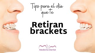 Tips para el día que te retiran BRACKETS [upl. by Fairweather]