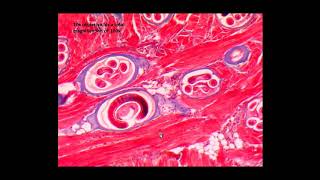 ORGANISM SLIDE Trichinella spiralis Microscope Slide [upl. by Behka]