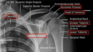 Age Estimation from Shoulder XRay [upl. by Gregrory]