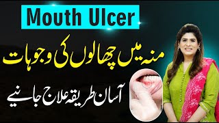 Mouth Ulcer Treatment  Muh Main Chale ka Ilaj  Dr Fareeha Tariq [upl. by Eekcaj322]