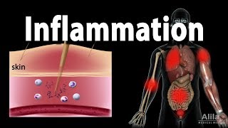 Inflammatory Response Animation [upl. by Defant]